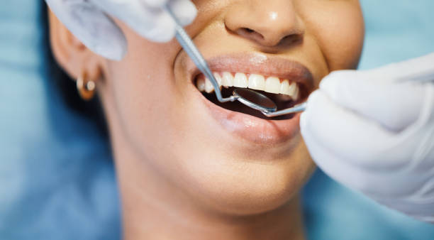 Best Emergency Gum Treatment in Port Wentworth, GA